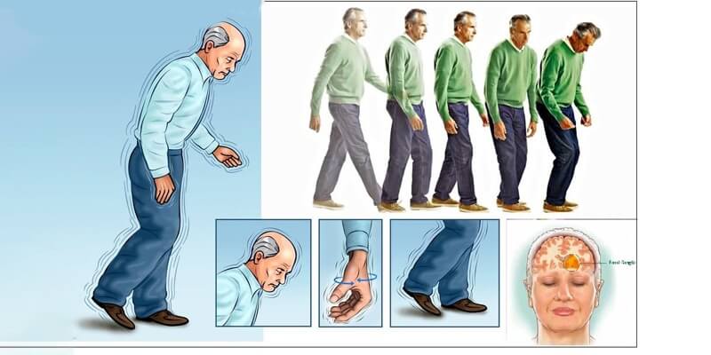 علائم آتاکسی یا اختلال تعادل
