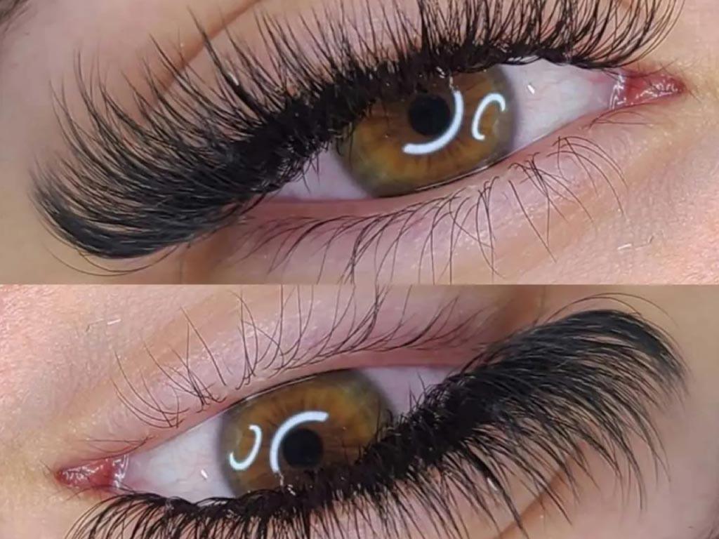 کاشت مژه مدل روباهی