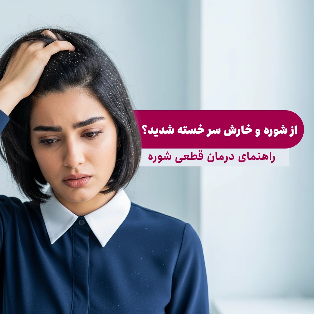 راهنمای درمان شوره سر